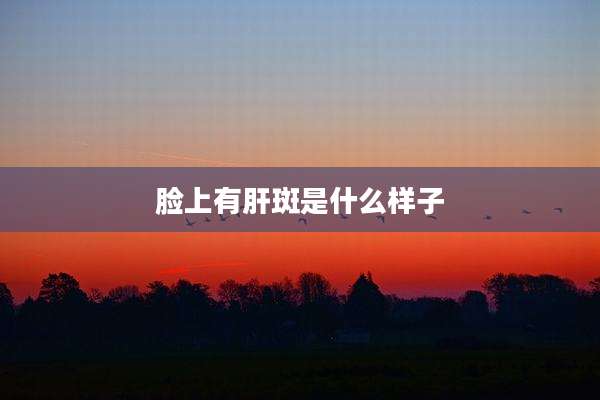 脸上有肝斑是什么样子