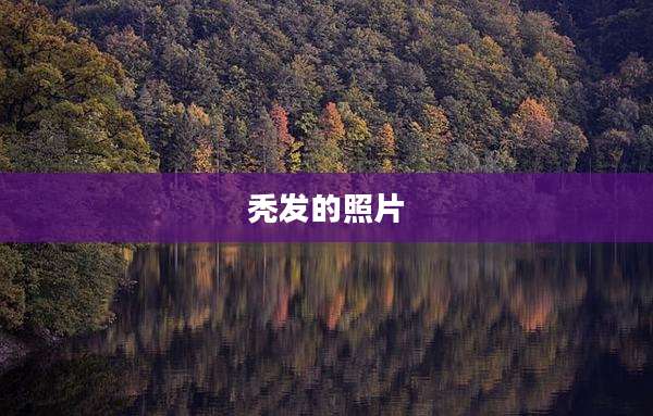 秃发的照片