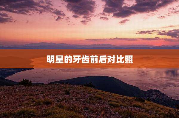 明星的牙齿前后对比照