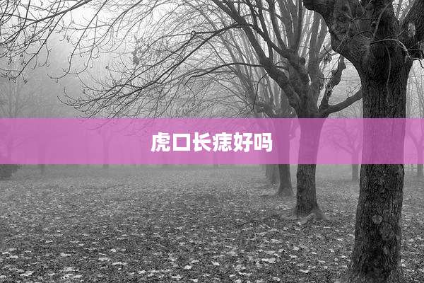虎口长痣好吗