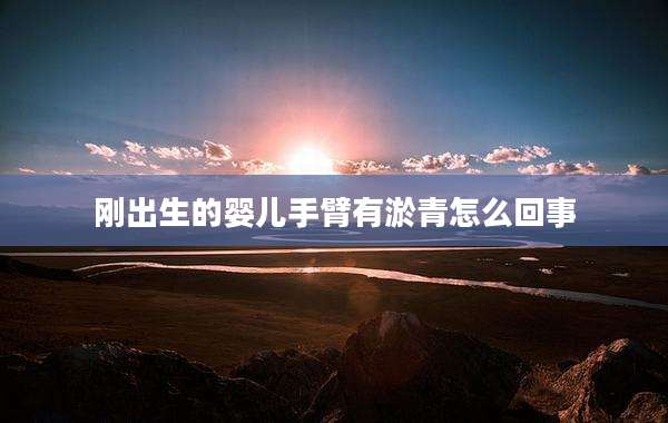 刚出生的婴儿手臂有淤青怎么回事