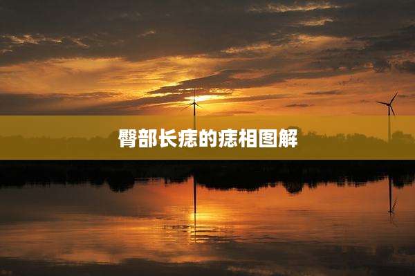 臀部长痣的痣相图解
